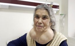 Doktor korkusundan 50 yıl böyle yaşadı! (Guatr belirtileri ve tedavi yöntemleri)
