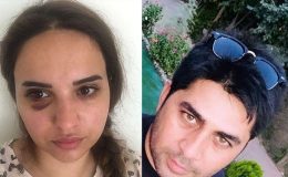 Bir yıldır boşanmak istiyordu, ne yaptıysa kurtulamadı! “Bana ne polis ne savcı bir şey yapamaz, arkam sağlam”