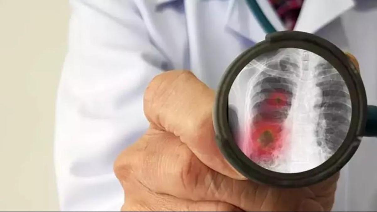 Covid-19’dan sonra en ölümcül hastalık! 10.8 milyon kişi…